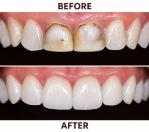 Dental AdvantEdge
